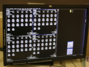 Scanner